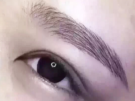 昆明内窥镜除皱去抬头纹医院哪家实力强（昆明内窥镜除皱去抬头纹整形医院）