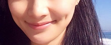 杭州隆鼻改善短鼻医院正规靠谱名单公开！杭州占美医疗美容医院技术厉害收费还不坑