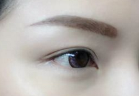 乌鲁木齐面部脂肪填充医院排行榜前三名性价比高、口碑好-乌鲁木齐面部脂肪填充均价为：4409元