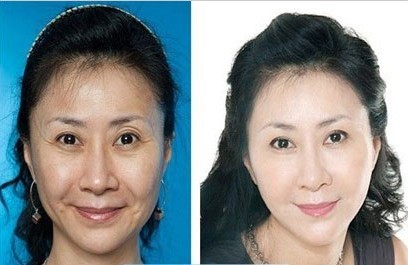 2025年深圳市产后做阴收缩整形医院上榜名单综合实力前十佳贴心推荐
